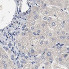 Anti-AFG3L2 Antibody