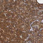 Anti-NDUFS3 Antibody