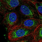 Immunofluorescent staining of human cell line MCF7 shows localization to nuclear bodies & mitochondria.