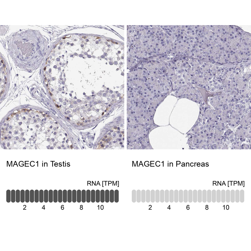 Anti-MAGEC1 Antibody
