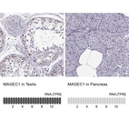 Anti-MAGEC1 Antibody