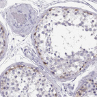 Immunohistochemical staining of human testis shows strong cytoplasmic positivity in spermatogonia.