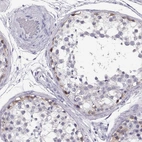 Immunohistochemical staining of human testis shows strong cytoplasmic positivity in spermatogonia.