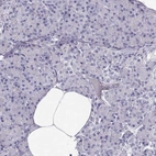 Immunohistochemical staining of human pancreas shows no cytoplasmic positivity in exocrine glandular cells.