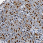 Immunohistochemical staining of human pancreas shows strong membranous positivity in exocrine glandular cells.