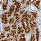 Immunohistochemical staining of human kidney shows strong membranous positivity in cells in tubules.