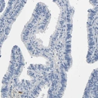 Immunohistochemical staining of human fallopian tube shows no positivity in glandular cells as expected.