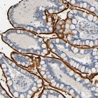 Immunohistochemical staining of human small intestine shows strong membranous positivity in glandular cells.