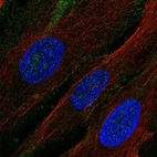 Immunofluorescent staining of human cell line BJ shows localization to plasma membrane.