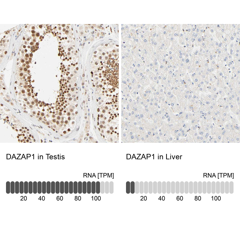 Anti-DAZAP1 Antibody