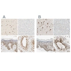 Immunohistochemical staining of human cerebral cortex, liver, skin and testis using Anti-DAZAP1 antibody HPA004631 (A) shows similar protein distribution across tissues to independent antibody HPA004201 (B).