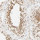 Immunohistochemical staining of human testis shows strong nuclear positivity in cells in seminiferous ducts.