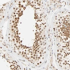 Immunohistochemical staining of human testis shows strong nuclear positivity in cells in seminiferous ducts.