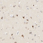 Immunohistochemical staining of human cerebral cortex shows moderate nuclear positivity in neurons.