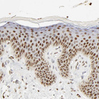Immunohistochemical staining of human skin shows moderate to strong nuclear positivity in squamous epithelial cells.