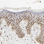 Immunohistochemical staining of human skin shows moderate to strong nuclear positivity in squamous epithelial cells.