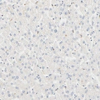 Immunohistochemical staining of human liver shows no weak positivity in hepatocytes as expected.
