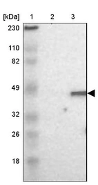 Lane 1: Marker [kDa] 230, 110, 82, 49, 32, 26, 18_br/_Lane 2: Human cell line RT-4_br/_Lane 3: Human cell line U-251MG sp
