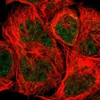 Immunofluorescent staining of human cell line A-431 shows localization to nucleoplasm & cytosol.