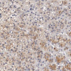 Anti-SEMA5A Antibody