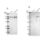 Western blot analysis using Anti-STRN3 antibody HPA004636 (A) shows similar pattern to independent antibody HPA003392 (B).