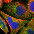 Immunofluorescent staining of human cell line A-431 shows localization to cytosol.