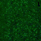 Anti-ARHGAP1 Antibody