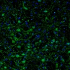 Immunofluorescence staining of mouse motor trigeminal nucleus shows positivity in neuronal cells bodies and processes.