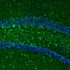Immunofluorescence staining of mouse dentate gyrus shows immunoreactivity in polymorph layer.