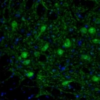 Immunofluorescence staining of mouse brain shows neuronal staining in lateral paragigantocellular nucleus.