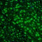 Immunofluorescence staining of mouse thalamus shows positivity in neurons of the anterodorsal thalamic nucleus.