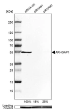 Western blot analysis in U-138MG cells transfected with control siRNA, target specific siRNA probe #1 and #2, using Anti-ARHGAP1 antibody. Remaining relative intensity is presented. Loading control: Anti-GAPDH.