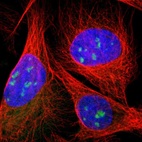 Immunofluorescent staining of human cell line U-2 OS shows localization to nucleoli.