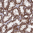 Immunohistochemical staining of human kidney shows strong granular cytoplasmic positivity in cells in tubules.