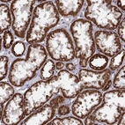 Immunohistochemical staining of human kidney shows strong granular cytoplasmic positivity in cells in tubules.