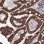 Immunohistochemical staining of human duodenum shows strong granular cytoplasmic positivity in glandular cells.