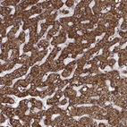 Immunohistochemical staining of human liver shows strong granular cytoplasmic positivity in hepatocytes.