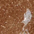 Anti-GSTZ1 Antibody