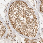 Immunohistochemical staining of human testis shows strong cytoplasmic positivity in cells in seminiferous ducts and leydig cells.