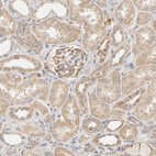 Anti-GSTZ1 Antibody