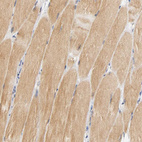 Anti-GSTZ1 Antibody