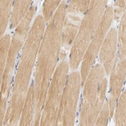 Immunohistochemical staining of human skeletal muscle shows moderate cytoplasmic positivity in myocytes.