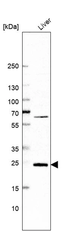 Western blot analysis in human liver tissue.