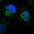Immunofluorescent staining of human cell line U-251 MG shows localization to nucleoplasm & the Golgi apparatus.