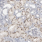 Immunohistochemical staining of human kidney shows moderate nuclear positivity in cells in tubules.