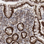 Immunohistochemical staining of human duodenum shows strong nuclear positivity in glandular cells.