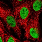 Immunofluorescent staining of human cell line CACO-2 shows localization to nucleoplasm.