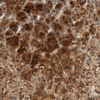 Anti-SCAP Antibody