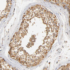 Anti-SCAP Antibody