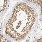Immunohistochemical staining of human Testis shows strong granular cytoplasmic positivity in cells in seminiferous ducts.